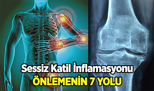 Sessiz Katil İnflamasyonu Önlemenin 7 Yolu