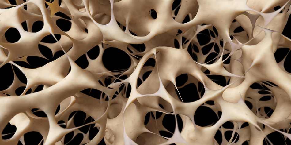 2020/12/1609194519_kemik-mineral-yogunlugu-kaybi-osteopeni.png