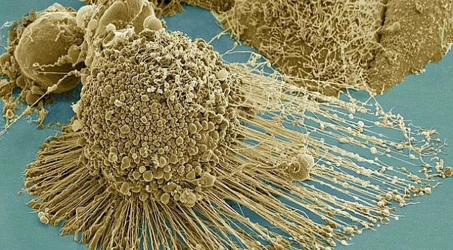 Kanserli hücreleri tamamen yok eden bir tedavi yöntemi bulundu