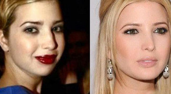 Ivanka Trump'ın estetiksiz hali görenleri şaşırttı