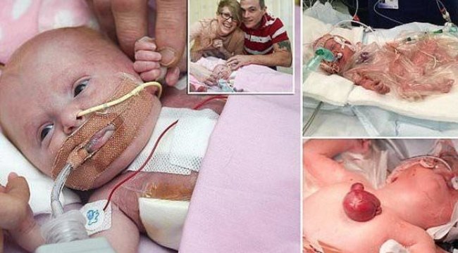 Doktorları bile şaşırttı: Onun adı mucize!