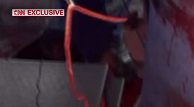 Kuzey Koreli askerin içinden çıkan 27 santimlik parazit!
