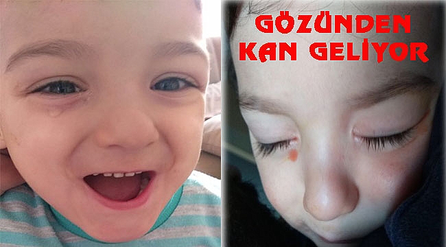 Minik Yusuf Yardımlarınızı Bekliyor