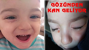 Minik Yusuf Yardımlarınızı Bekliyor