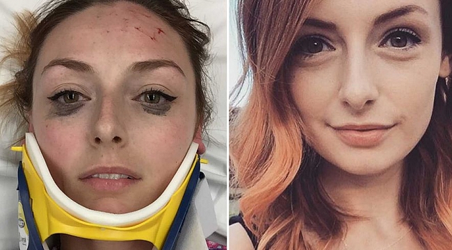 Yaralının Selfie Pozu: Sosyal Medya Yıkıldı