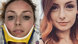 Yaralının Selfie Pozu: Sosyal Medya Yıkıldı