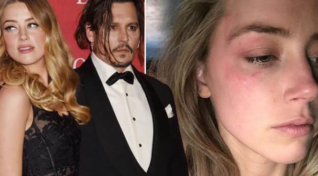 Johnny Depp: “Acıyı kaldıramadım”
