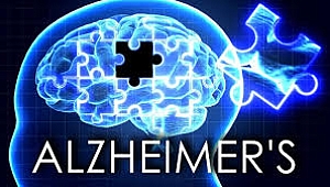 ABD'de Neden Alzhimer artıyor?