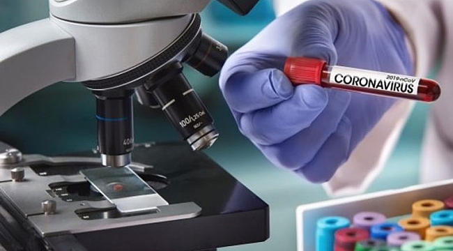 Çin'den Gelen Corona Test Kiti Hatalı mı?