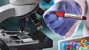 Çin'den Gelen Corona Test Kiti Hatalı mı?