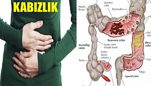 Kabızlık Sorunu Yaşıyorsanız En Etkili Çözüm Yöntemleri