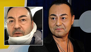 Serdar Ortaç, kaş yapayım derken göz çıkardı!