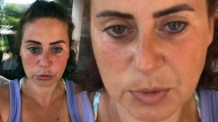 Ünlü oyuncu aynı maskeyi kullanınca enfeksiyon kap