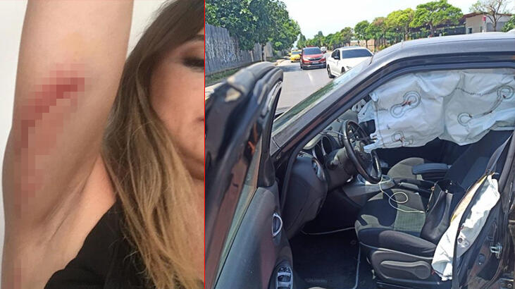 Zeynep Tandoğan trafik kazası geçirdi!