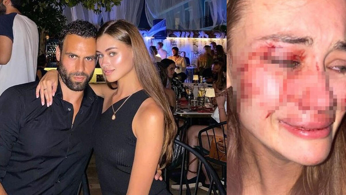 Kanlar içindeki fotoğrafı ile olay olan Daria Kyry