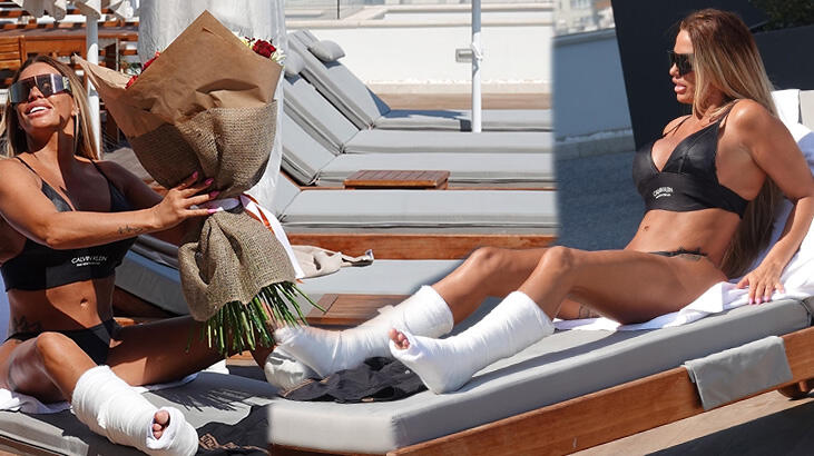 Katie Price tatilde kaza geçirdi! İki bacağı da al