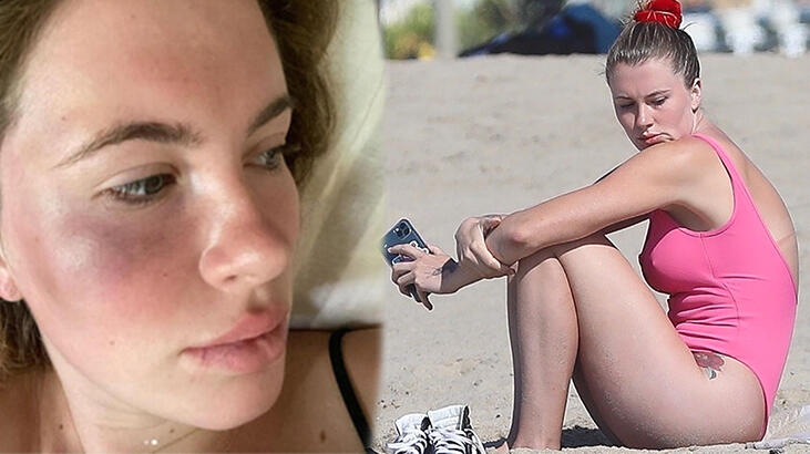 Ireland Baldwin darbedildikten sonra ilk kez görün