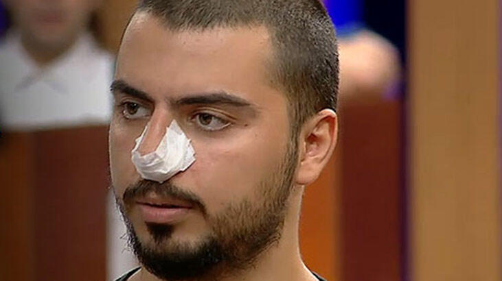 MasterChef Serhat'ın burnuna ne oldu?
