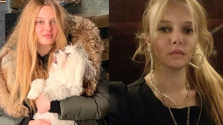 Naz Elmas'ın yüzü 'estetik mi photoshop mu?'