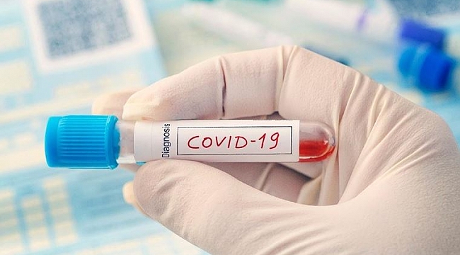 Kovid-19 Aşısının KDV'si Belirlendi