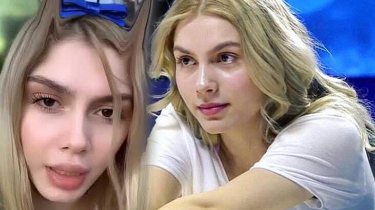 Aleyna Tilki'nin dudakları nasıl şişti?