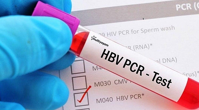 Covid-19 Test Sonucu En Çabuk Nereden Alınır?