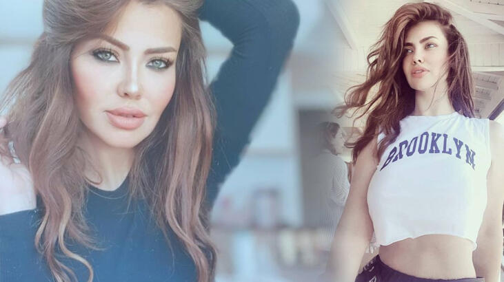 Ameliyatla dudaklarını küçülttüren Lara eleştirile