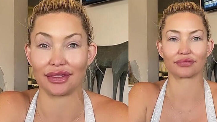 Kate Hudson: Bana ne yaptınız böyle!