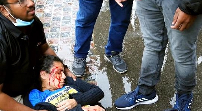 Charlie Hebdo Tişörtü Giyen Türk Bıçaklandı