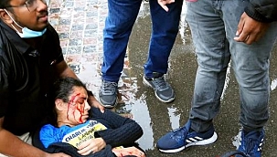 Charlie Hebdo Tişörtü Giyen Türk Bıçaklandı