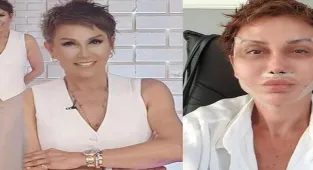 Estetik operasyon geçirmişti! İşte Serap Paköz'ün son hali