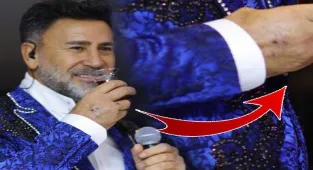 Haberler: Yara izleri dikkat çeken İzzet Yıldızhan talihsiz kazayı anlattı!