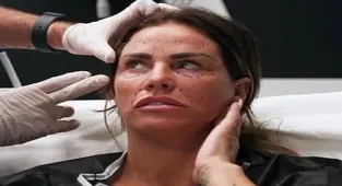 Katie Price Türkiye'de yaptırdığı estetik operasyonu YouTube'da yayınladı