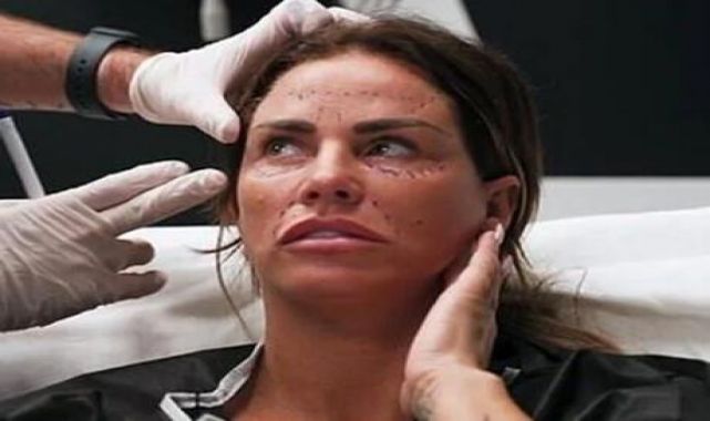 Katie Price Türkiye'de yaptırdığı estetik operasyonu YouTube'da yayınladı
