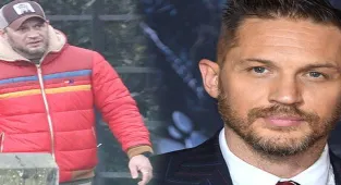 Tom Hardy: Venom'dan sonra iki ameliyat geçirmem gerekti