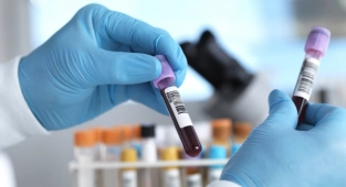 Kanseri Erken Teşhis Eden Kan Testi Geliştirildi