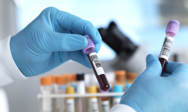 Kanseri Erken Teşhis Eden Kan Testi Geliştirildi