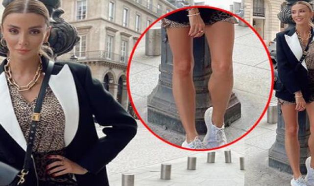Özge Ulusoy'un fotoğrafları dikkat çekti! Gerçek mi photoshop mu?