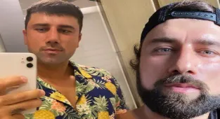 Burun estetiği yaptıran Survivor Yasin Obuz'un son hali!