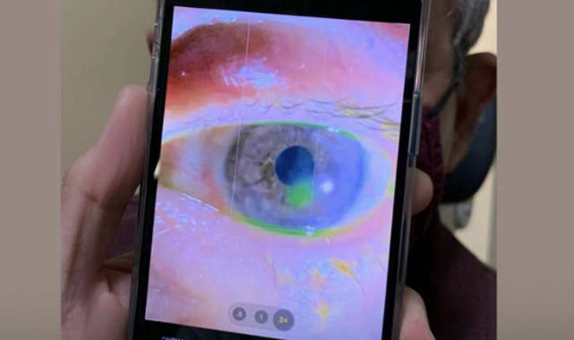 Californialı Göz Doktoru iPhone 13 İle Tedavi Ediyor