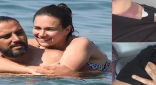 Haberler: Ameliyatı 5.5 saat süren Alişan'dan 'estetik' davası! 'Denize tişörtle giriyorum'