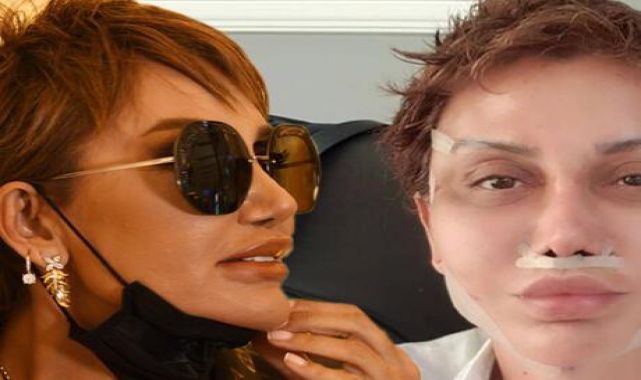 Haberler: Son hali sosyal medyada gündem olan Serap Paköz'den 'estetik' açıklaması!