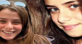 İlayda Alişan'dan 'estetik' tepkisi!