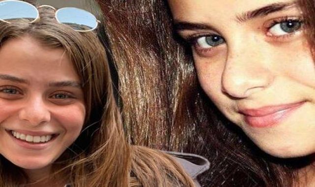 İlayda Alişan'dan 'estetik' tepkisi!