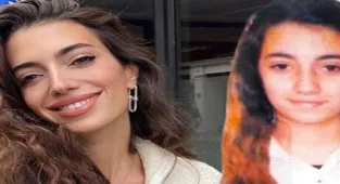 Rachel Araz 'estetik' iddialarına cevap verdi!