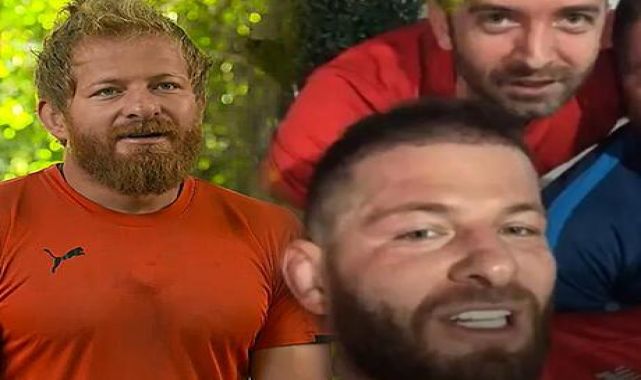 Survivor şampiyonu İsmail Balaban diş estetiği yaptırdı