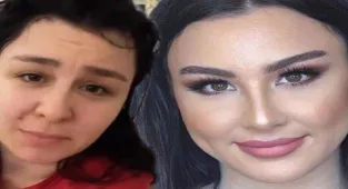 Yasemin Sakallıoğlu'nun 'photoshop' isyanı: Benim öyle bir ağzım burnum yok!