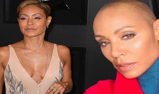 Jada Pinkett Smith sağlık sorununu anlattı: Avucum dökülen saçlarımla doldu!