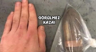 Koleksiyonundaki Tanksavar Mermisi Makatına Kaçtı