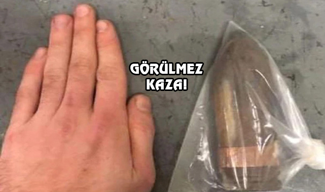 Koleksiyonundaki Tanksavar Mermisi Makatına Kaçtı